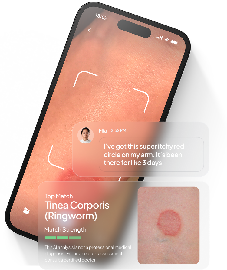 Rash ID Mobile App Interface