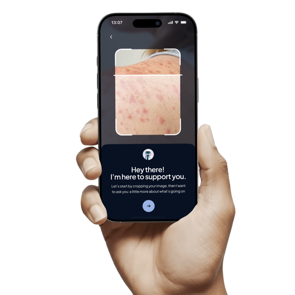 A hand holding the Rash ID app on a phone screen. The app is going to to diagnose a skin disorder.